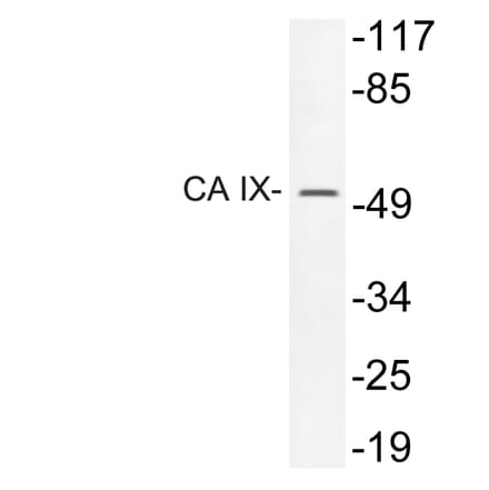 Western Blot - Anti-CA IX Antibody (R12-2047) - Antibodies.com