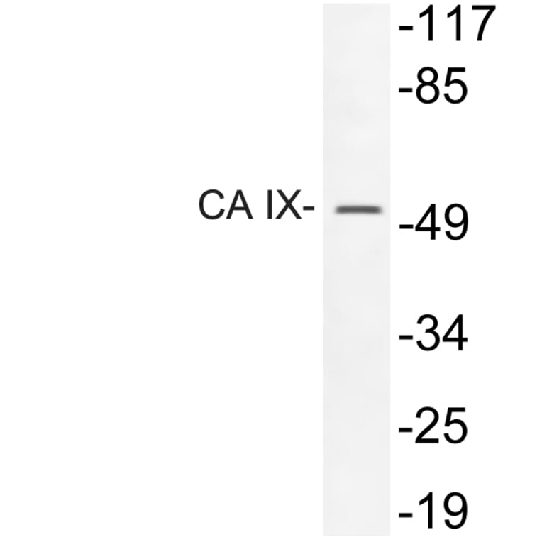 Western Blot - Anti-CA IX Antibody (R12-2047) - Antibodies.com