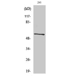 Western Blot - Anti-CA IX Antibody (R12-2047) - Antibodies.com