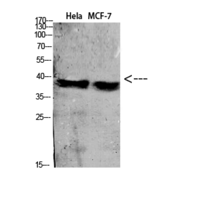 Western Blot - Anti-C5AR1 Antibody (C30396) - Antibodies.com