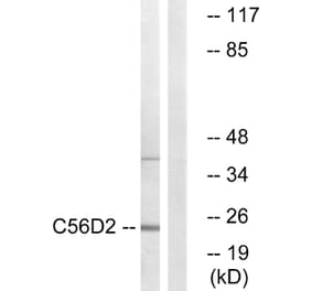 Western Blot - Anti-C56D2 Antibody (C12082) - Antibodies.com