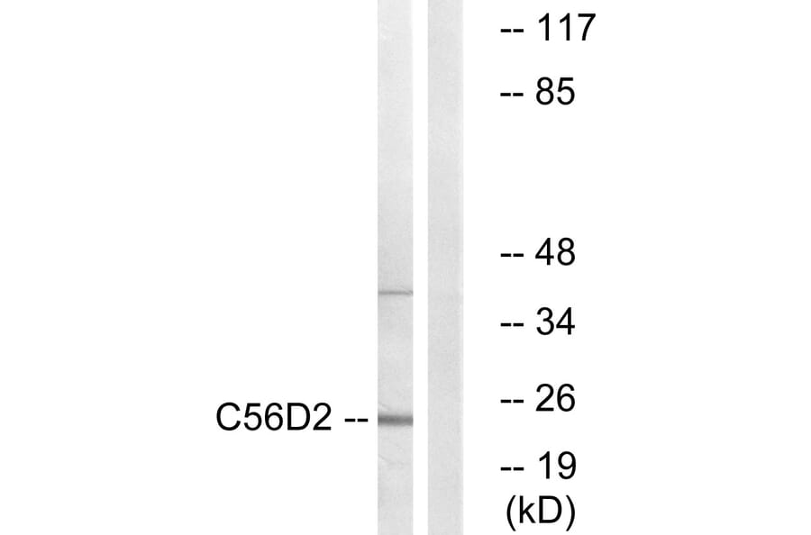 Western Blot - Anti-C56D2 Antibody (C12082) - Antibodies.com
