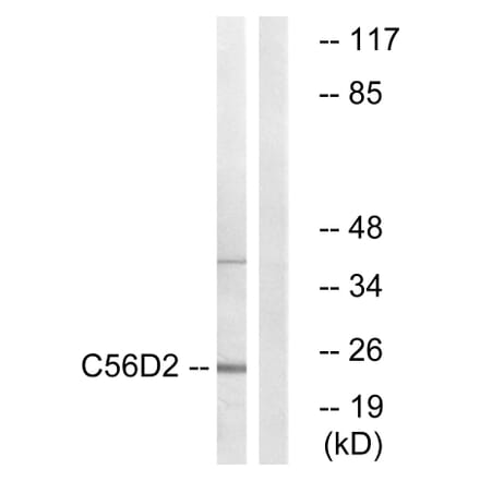 Western Blot - Anti-C56D2 Antibody (C12082) - Antibodies.com