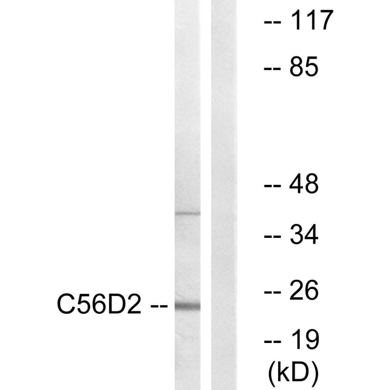 Western Blot - Anti-C56D2 Antibody (C12082) - Antibodies.com