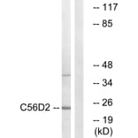 Western Blot - Anti-C56D2 Antibody (C12082) - Antibodies.com