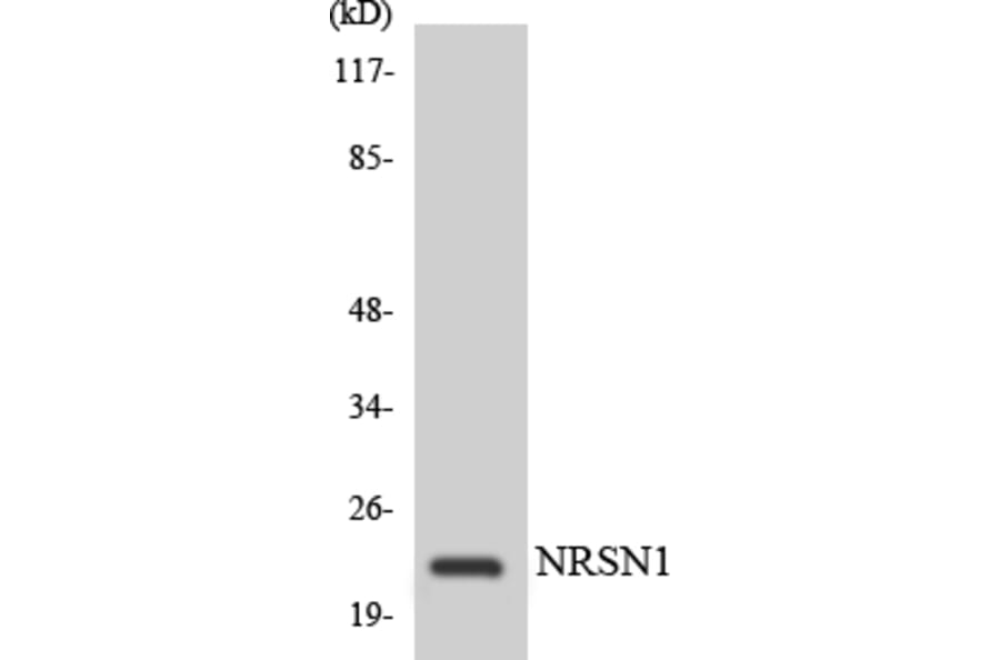 Western Blot - Anti-C56D2 Antibody (R12-2553) - Antibodies.com