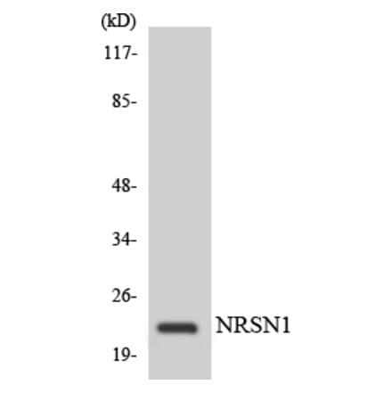 Western Blot - Anti-C56D2 Antibody (R12-2553) - Antibodies.com