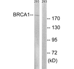 Western Blot - Anti-BRCA1 Antibody (B8306) - Antibodies.com
