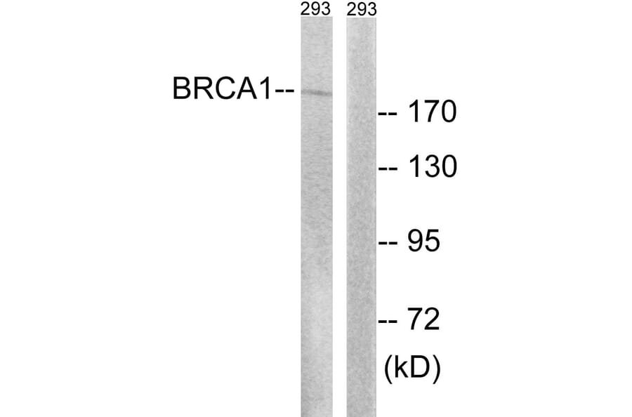 Western Blot - Anti-BRCA1 Antibody (B8306) - Antibodies.com
