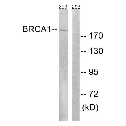 Western Blot - Anti-BRCA1 Antibody (B8306) - Antibodies.com