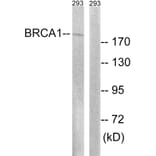 Western Blot - Anti-BRCA1 Antibody (B8306) - Antibodies.com