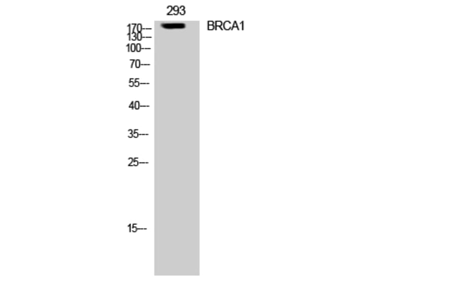 Western Blot - Anti-BRCA1 Antibody (B8306) - Antibodies.com