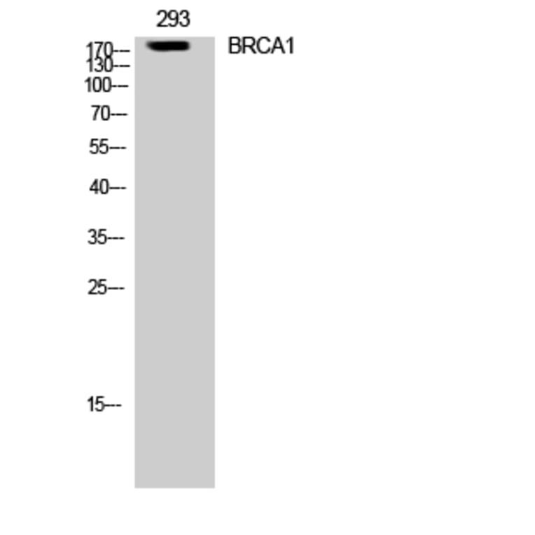 Western Blot - Anti-BRCA1 Antibody (B8306) - Antibodies.com