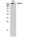 Western Blot - Anti-BRCA1 Antibody (B8306) - Antibodies.com