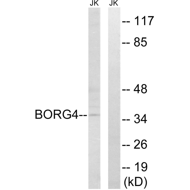 Western Blot - Anti-BORG4 Antibody (C15025) - Antibodies.com