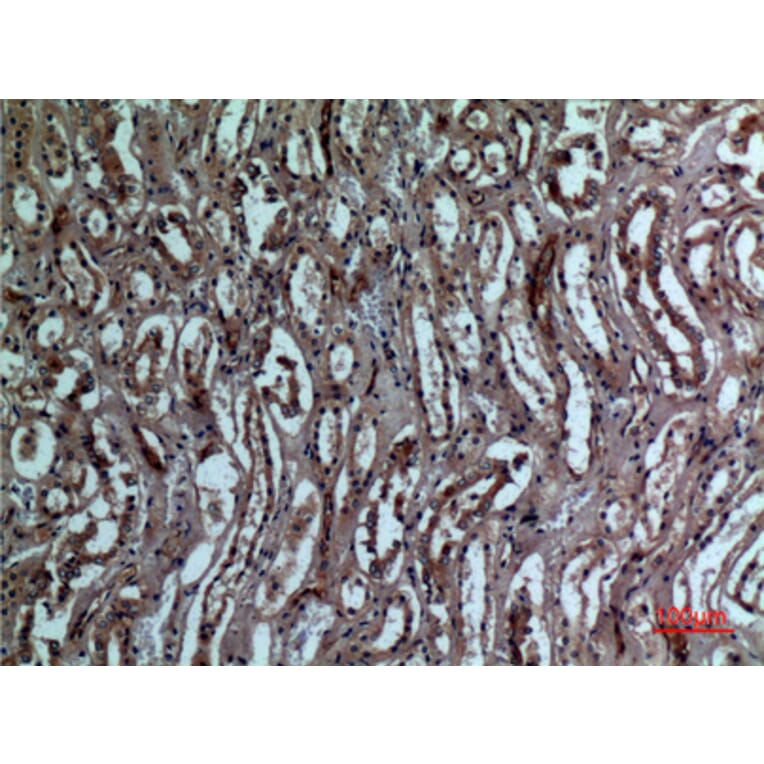 Immunohistochemistry - Anti-BNIP3 Antibody (C30029) - Antibodies.com