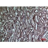 Immunohistochemistry - Anti-BNIP3 Antibody (C30029) - Antibodies.com