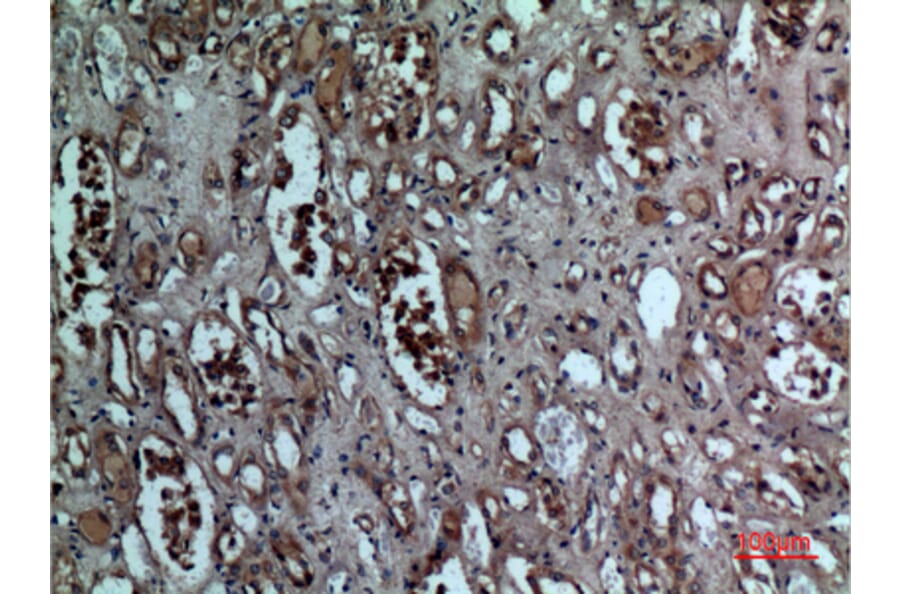 Immunohistochemistry - Anti-BNIP3 Antibody (C30029) - Antibodies.com