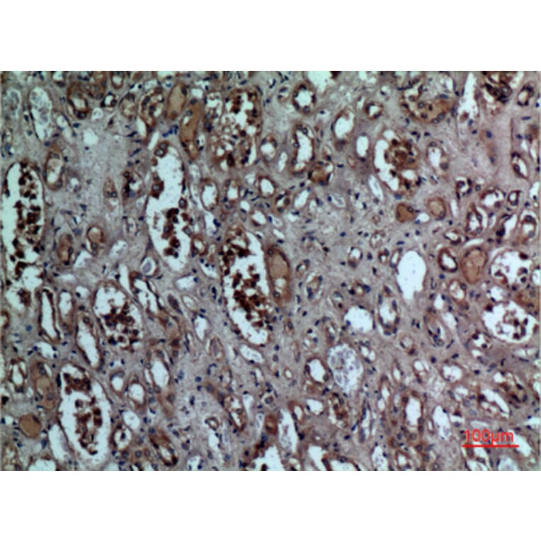 Immunohistochemistry - Anti-BNIP3 Antibody (C30029) - Antibodies.com