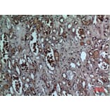 Immunohistochemistry - Anti-BNIP3 Antibody (C30029) - Antibodies.com