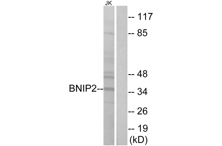 Western Blot - Anti-BNIP2 Antibody (C14696) - Antibodies.com