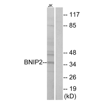 Western Blot - Anti-BNIP2 Antibody (C14696) - Antibodies.com