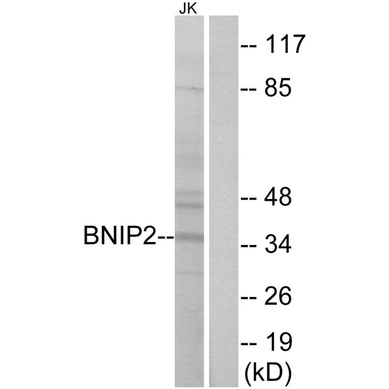 Western Blot - Anti-BNIP2 Antibody (C14696) - Antibodies.com