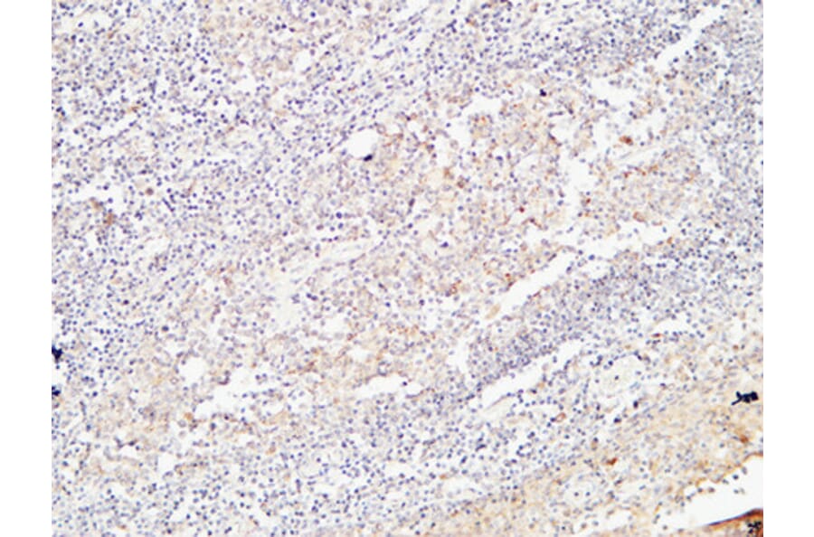 Immunohistochemistry - Anti-BMP15 Antibody (C30665) - Antibodies.com