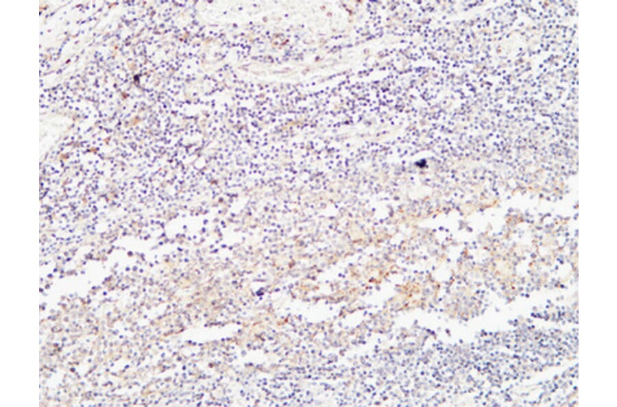 Immunohistochemistry - Anti-BMP15 Antibody (C30665) - Antibodies.com