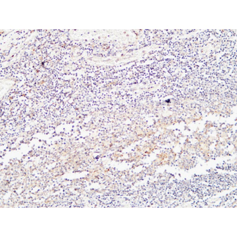 Immunohistochemistry - Anti-BMP15 Antibody (C30665) - Antibodies.com