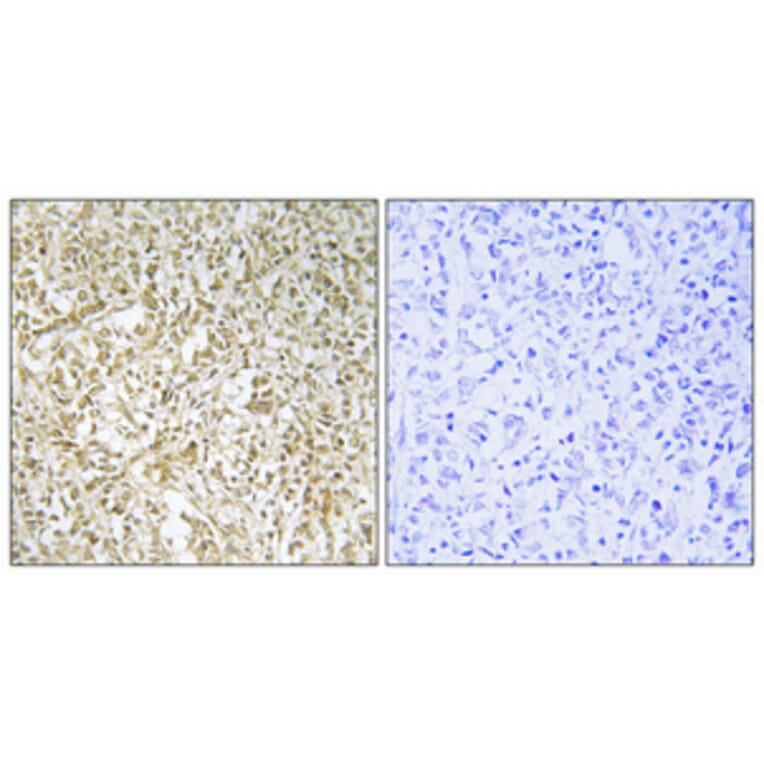 Immunohistochemistry - Anti-BARD1 Antibody (C13026) - Antibodies.com