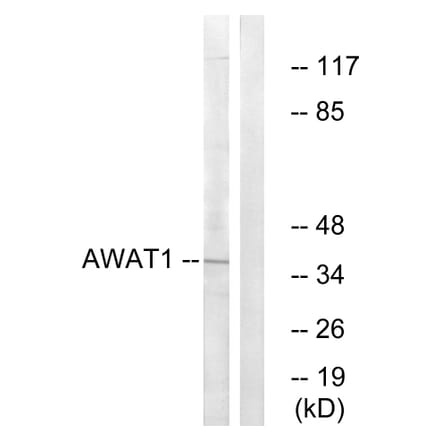 Western Blot - Anti-AWAT1 Antibody (C14257) - Antibodies.com