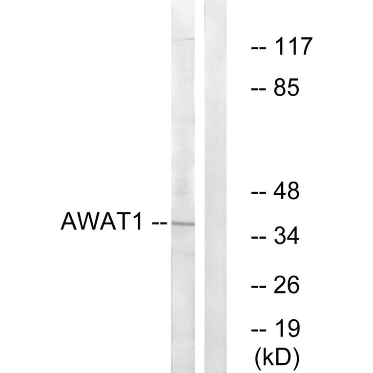 Western Blot - Anti-AWAT1 Antibody (C14257) - Antibodies.com