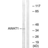 Western Blot - Anti-AWAT1 Antibody (C14257) - Antibodies.com
