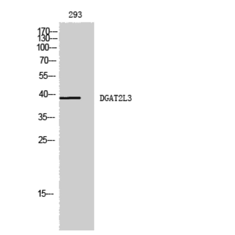 Western Blot - Anti-AWAT1 Antibody (C14257) - Antibodies.com