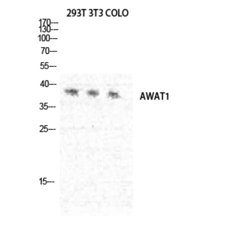 Western Blot - Anti-AWAT1 Antibody (C14257) - Antibodies.com
