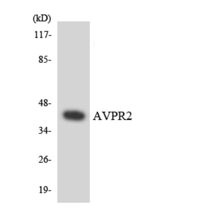 Western Blot - Anti-AVPR2 Antibody (R12-2527) - Antibodies.com