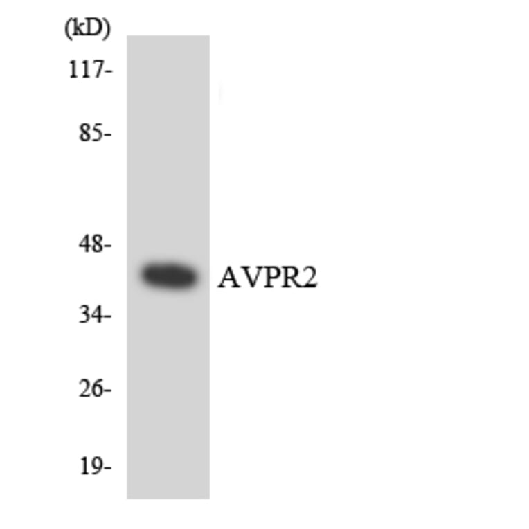 Western Blot - Anti-AVPR2 Antibody (R12-2527) - Antibodies.com