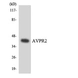 Western Blot - Anti-AVPR2 Antibody (R12-2527) - Antibodies.com