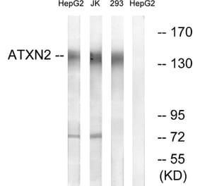 Western Blot - Anti-ATXN2 Antibody (C14578) - Antibodies.com