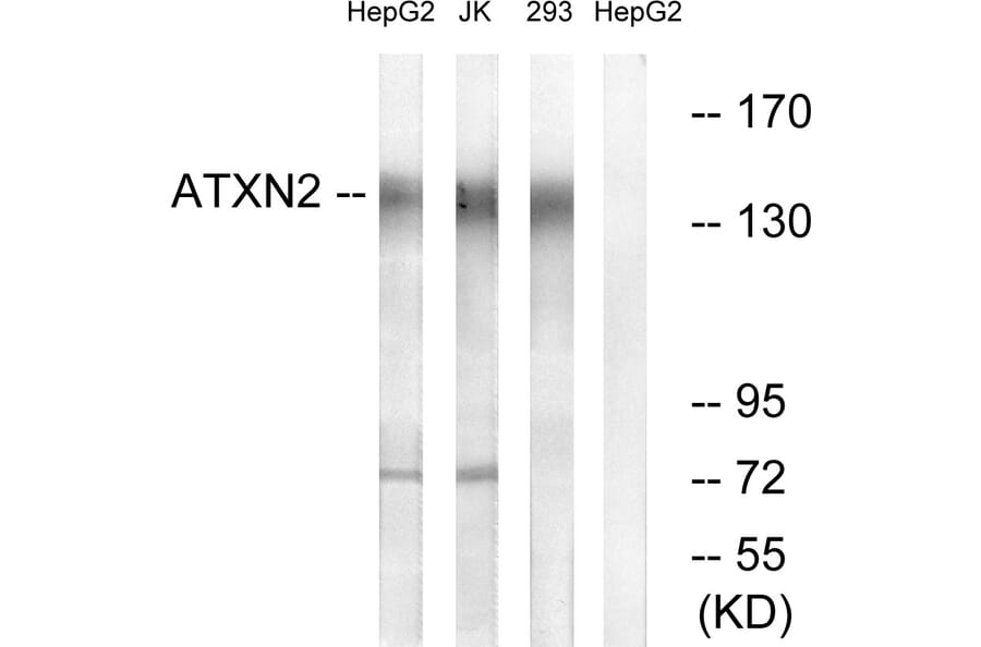 Western Blot - Anti-ATXN2 Antibody (C14578) - Antibodies.com