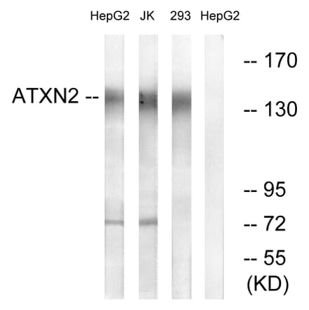 Western Blot - Anti-ATXN2 Antibody (C14578) - Antibodies.com