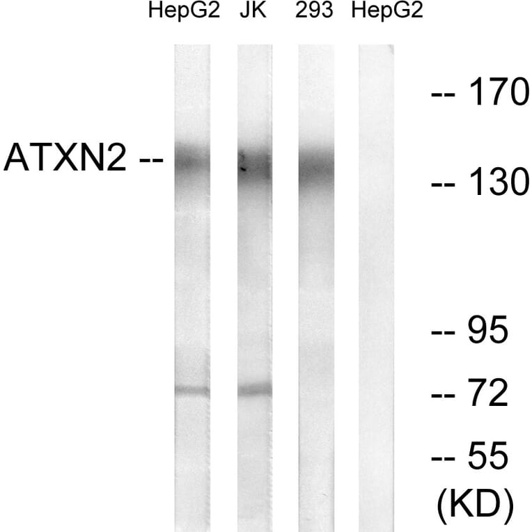 Western Blot - Anti-ATXN2 Antibody (C14578) - Antibodies.com