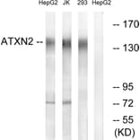 Western Blot - Anti-ATXN2 Antibody (C14578) - Antibodies.com