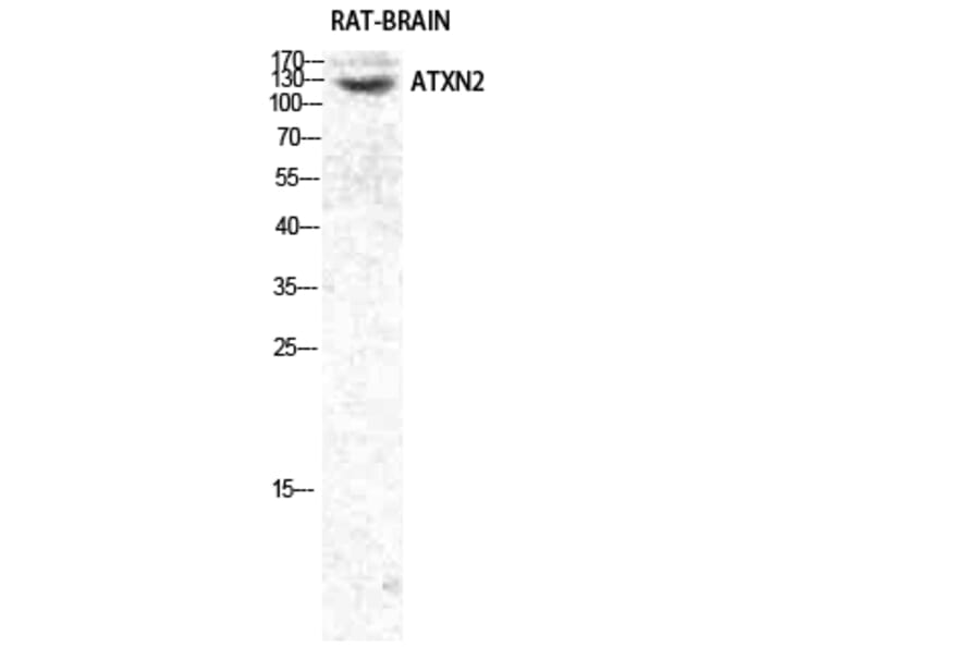 Western Blot - Anti-ATXN2 Antibody (C14578) - Antibodies.com