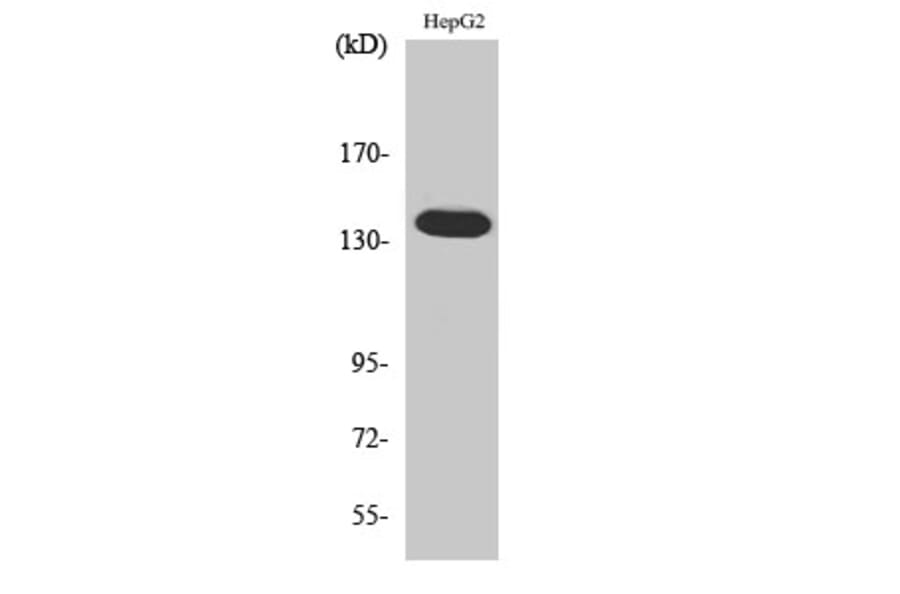 Western Blot - Anti-ATXN2 Antibody (C14578) - Antibodies.com