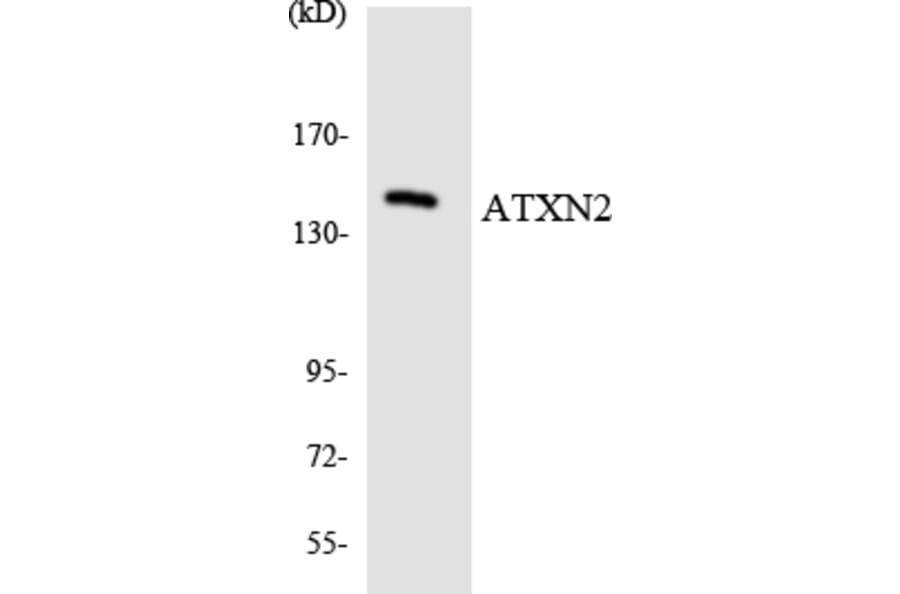 Western Blot - Anti-ATXN2 Antibody (R12-2523) - Antibodies.com