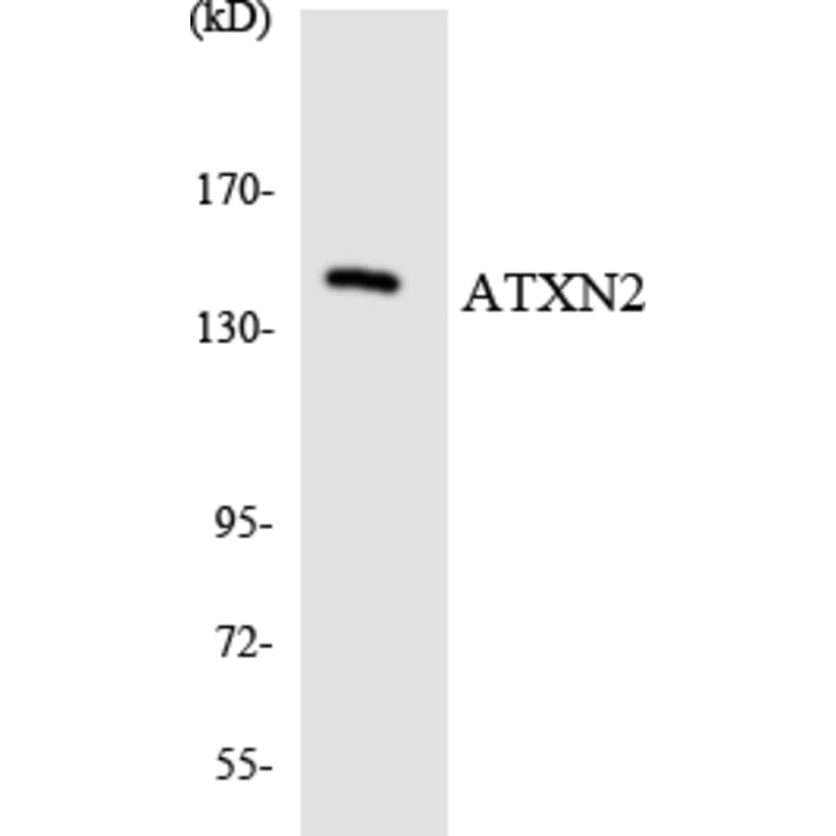 Western Blot - Anti-ATXN2 Antibody (R12-2523) - Antibodies.com