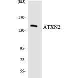 Western Blot - Anti-ATXN2 Antibody (R12-2523) - Antibodies.com