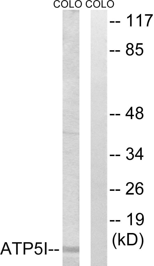 Western blot analysis of lysates from COLO cells using Anti-ATP5I Antibody. The right hand lane represents a negative control, where the antibody is blocked by the immunising peptide.